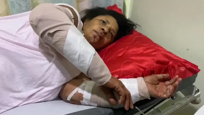 Dos perros pitbull atacan y hieren a una mujer en Santiago