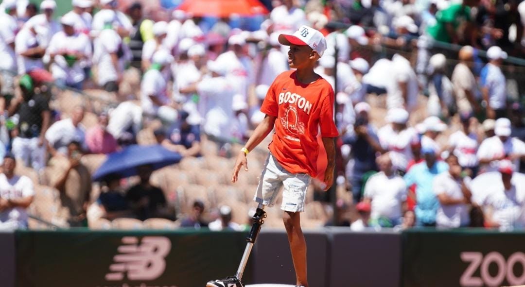 Adolescente de 13 años participa en juego de exhibición Grandes Ligas con prótesis gestionada por SeNaSa