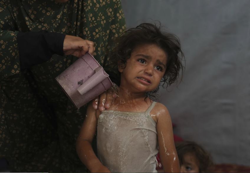 En Gaza, el calor del verano agrava la lucha diaria por sobrevivir