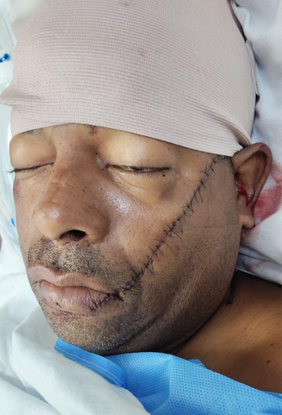 Dos heridos tras enfrentamiento en un juego de dominó en Los Botados