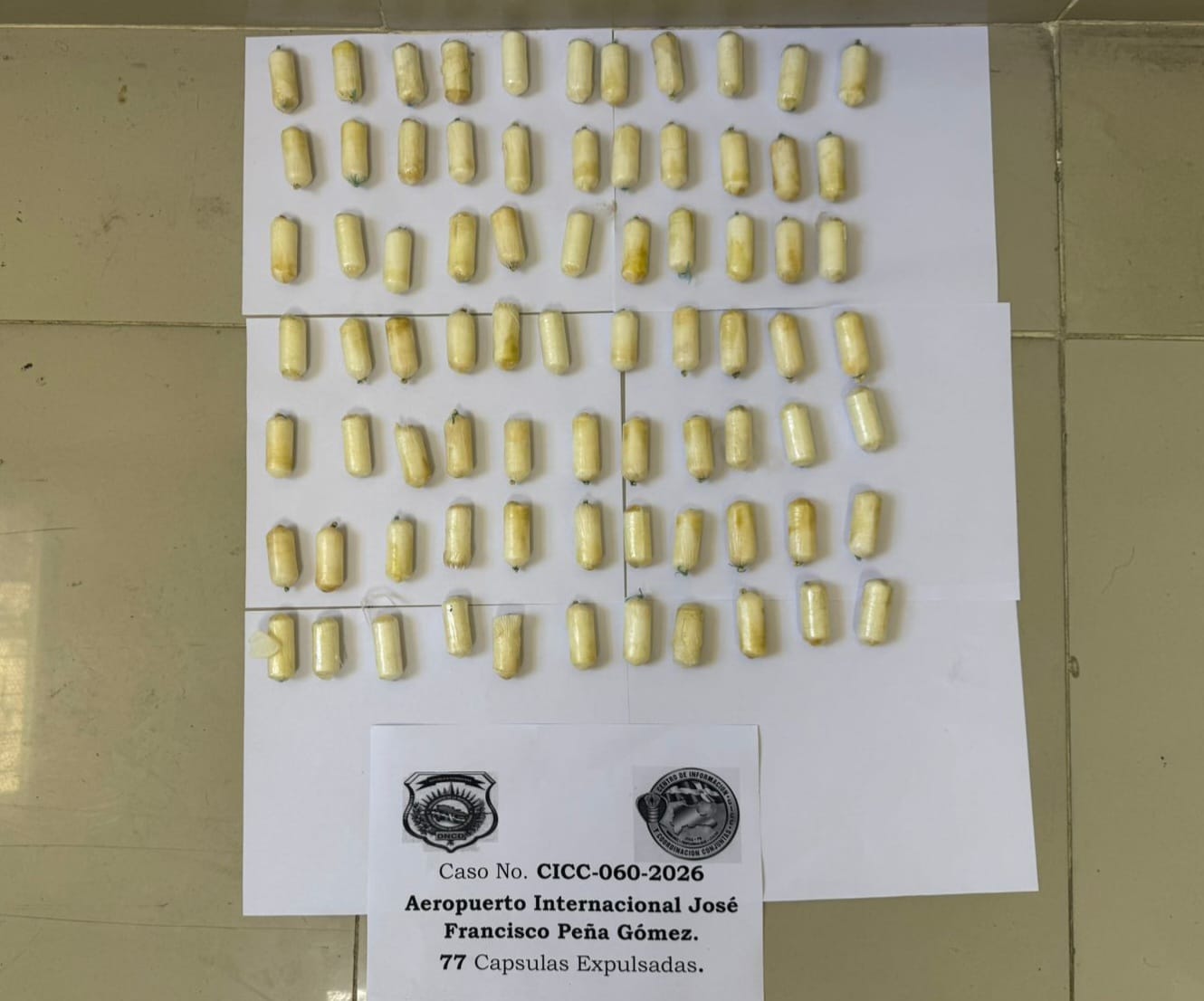 Arrestan Español en el AILA con el estómago lleno de bolsitas de presunta cocaina