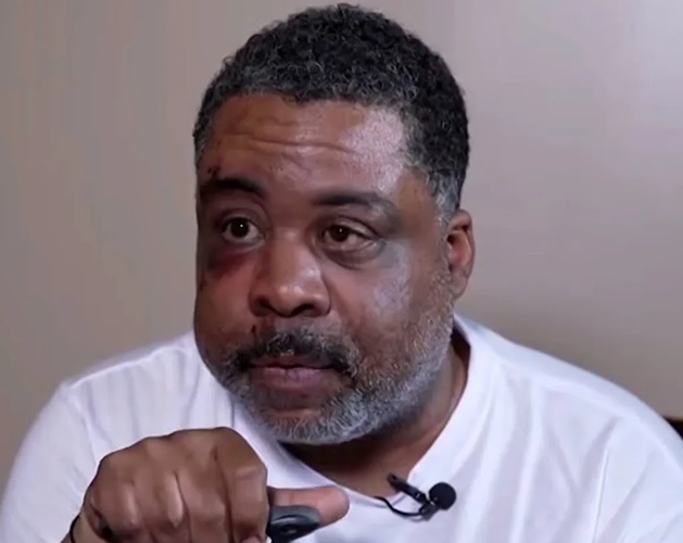 Hombre agredido en Brooklyn demanda al NYPD por 100 millones de dólares