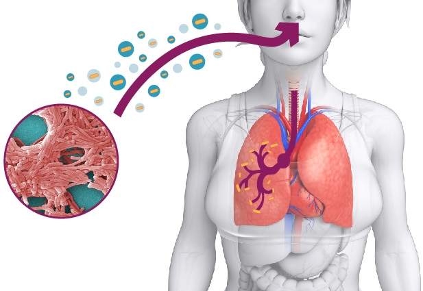 NYC declara emergencia por brote de Legionella