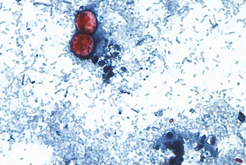 Funcionarios estadounidenses vinculan brote de ciclospora que afecta lechuga iceberg con otros 3 estados