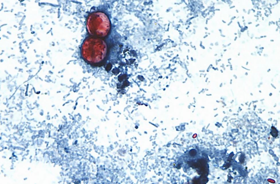 La FDA ha detectado Cyclospora en una granja mexicana vinculada a un brote de lechuga